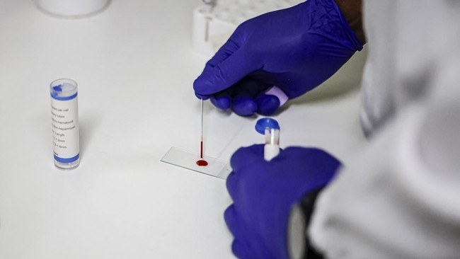 Kasus malaria meningkat di sejumlah wilayah di Afrika. Penyebaran malaria didukung perubahan iklim yang mengubah pola curah hujan dan suhu.