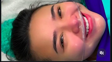 Amanda Manopo Bongkar Detik-detik Melahirkan Baby Zac, Ungkap Momen Mendebarkan bareng Kenny Austin