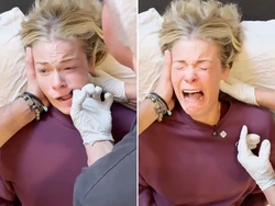 Terapi Rahang Viral yang Bikin Nangis, Disebut Bisa Lepaskan Emosi Terpendam