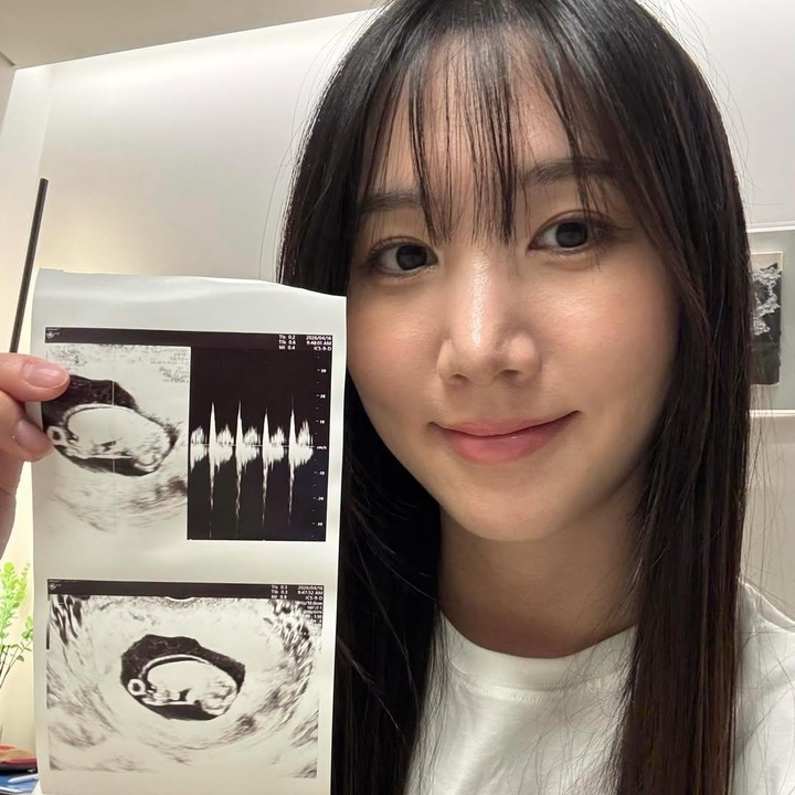 <p>Hong Yu Kyung mengejutkan publik usai mengunggah foto dirinya dan hasil USG yang menunjukkan bahwa ia tengah hamil anak pertama. Pada 31 Mei 2026, ia berbagi kabar bahagia tersebut lewat media sosial pribadinya. &ldquo;Bayi cantik ada di perutku. Sudah lama aku ingin mengumumkannya kepada kalian, tapi aku malu. Sekarang usia kehamilanku sudah masuk 16 minggu.&rdquo; Foto: Instagram @Yukyung_922</p>
