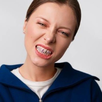 Kenalan dengan Grillz Teeth, Aksesori di Kalangan Anak Hip-Hop yang Kembali Populer