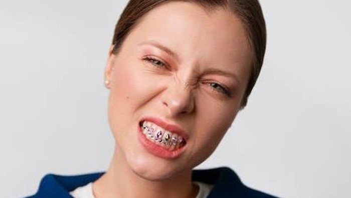 Kenalan dengan Grillz Teeth, Aksesori di Kalangan Anak Hip-Hop yang Kembali Populer