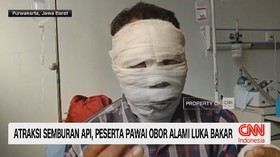 Atraksi Semburan Api, Peserta Pawai Obor Alami Luka Bakar