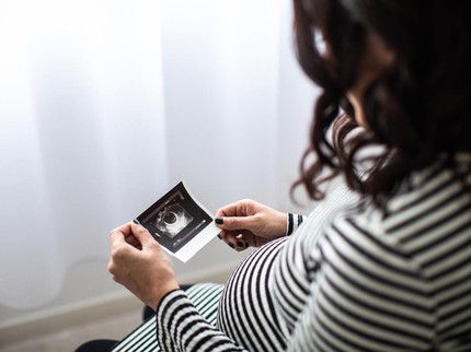 Pasangan Ini Putuskan Berpisah usai Jalani Program IVF, Bagaimana Hak Asuh Anak?