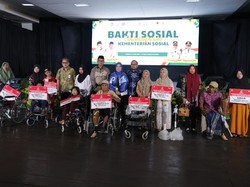 Kemensos Berikan Kaki Palsu untuk Korban Gigitan Buaya di Gowa