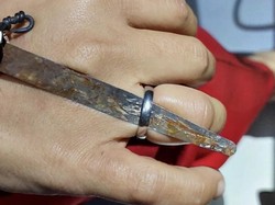 25 Menit Menegangkan Saat Damkar Sukabumi Potong Cincin Menjepit Jari