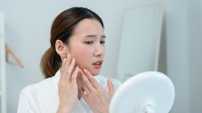 Kisah Bunda Baru Menyadari Hamil Setelah Mengalami Jerawat Parah
