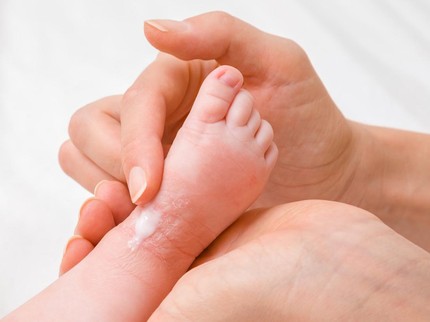 4 Kondisi Medis Penyebab Kulit Bayi Mengelupas dan Cara Mengatasinya