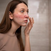 Cara Memperbaiki Skin Barrier