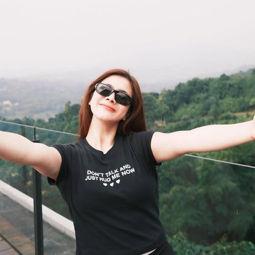 Jawaban Felicya Angelista Usai Diduga Operasi Plastik karena Wajah Berubah