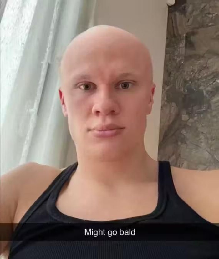 Hobi kibas rambut di lapangan, bagaimana&nbsp;jadinya jika Haaland botak? Sang bintang langsung memberi gambaran lewat akun Snapchatnya sendiri!/Foto: Dok. Snapchat/Erling Haaland