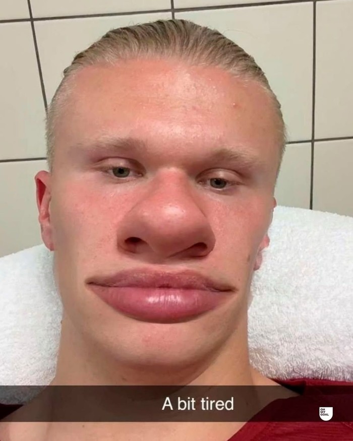 Erling Haaland kerap membagikan momen dan komentar kocaknya melalui media sosial Snapchat. Hal ini membuatnya semakin viral di kalangan netizen, Beauties!/Foto: Dok. Snapchat/Erling Haaland