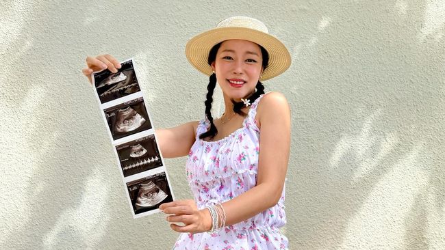 Potret Kehamilan Go Woo Ri Eks Rainbow, Happy Bakal Punya Anak Laki-Laki