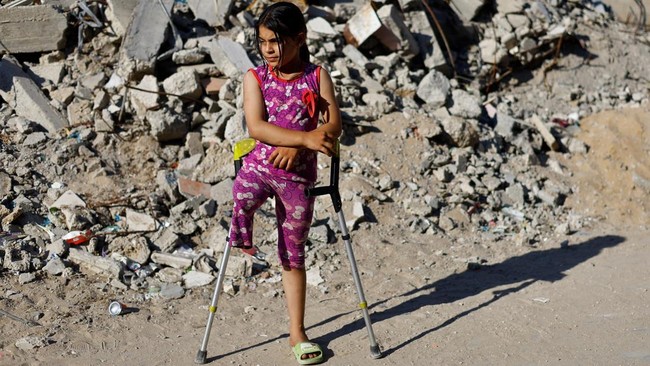 Potret Para Bocah Gaza yang Kehilangan Kaki Akibat Kekejaman Israel