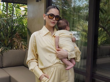 Alyssa Daguise Curhat Rambutnya Rontok Pasca Melahirkan, Relate Bun?