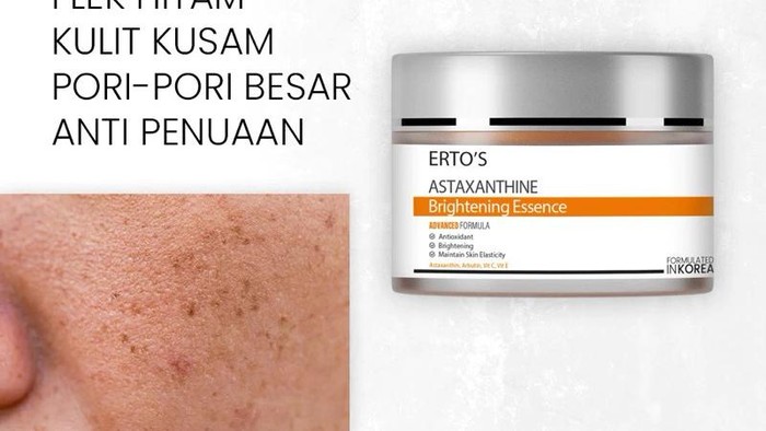 BeauPicks: 5 Rekomendasi Skincare dari Brand Lokal untuk Mengatasi Flek Hitam