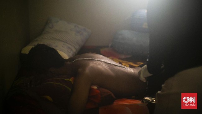 Di balik punggung yang perlahan berubah bentuk, tersimpan kisah perjuangan Refan (14) seorang remaja untuk kembali berdiri tegak melawan skoliosis yang dapat berkembang pesat saat tubuh memasuki fase pertumbuhan. Skoliosis merupakan kondisi tulang be