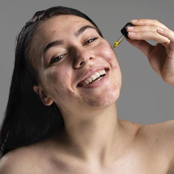 Menurut Dokter, Ini 8 Kandungan Skincare yang Sebaiknya Dihindari saat Kulit Iritasi
