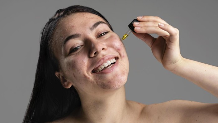 Menurut Dokter, Ini 8 Kandungan Skincare yang Sebaiknya Dihindari saat Kulit Iritasi