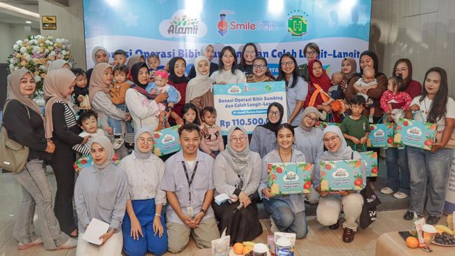 Alamii Food Gelar Operasi Bibir Sumbing Gratis bagi 17 Anak Indonesia