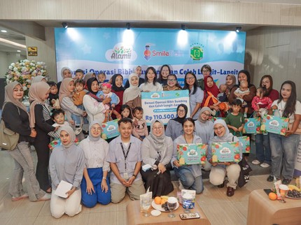 Alamii Food Gelar Operasi Bibir Sumbing Gratis bagi 17 Anak Indonesia