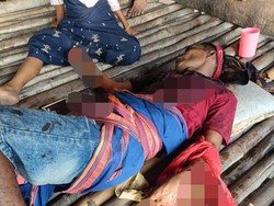 Guru di Sumba Barat Daya Luka Parah Usai Dibacok Saat Acara Adat