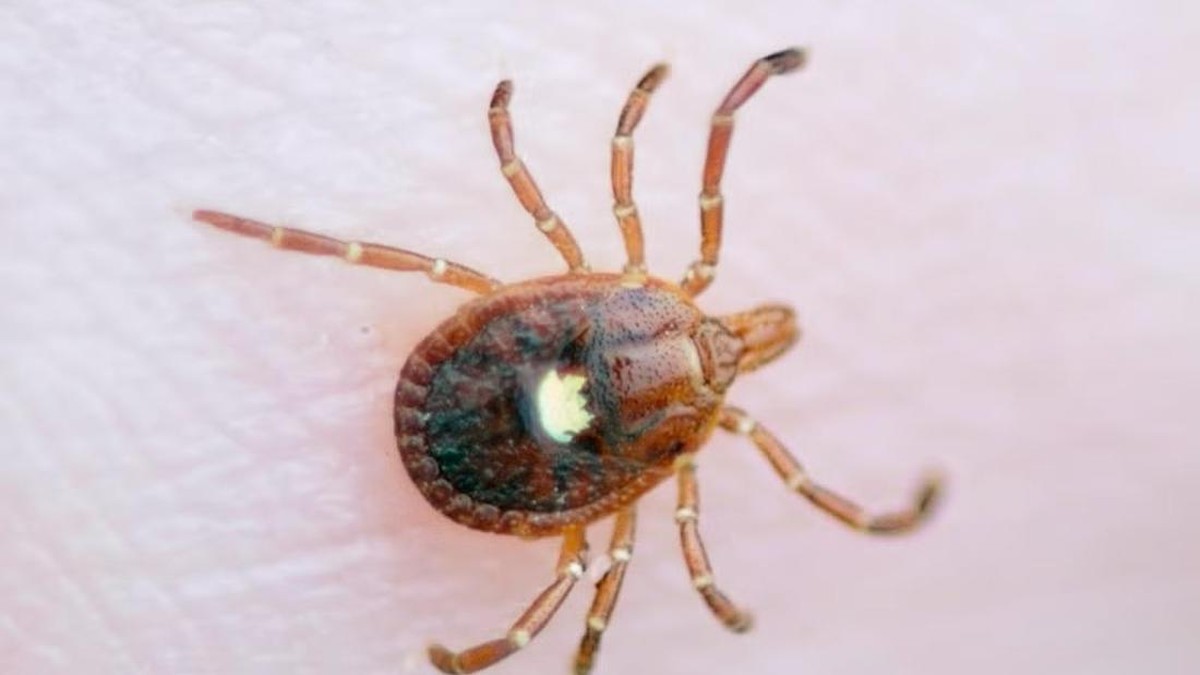 Geger Muncul Virus Langka yang Belum Punya Obatnya, Picu Kekhawatiran