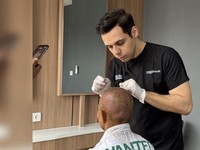 Rontok Usia 20-an? Ini Solusi Permanen dan Cara Mencegahnya Lebih Awal