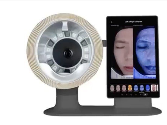 Apakah Alat Skin Analyzer AI Ini Lebih Akurat dari Analisa Kulit Manual? 