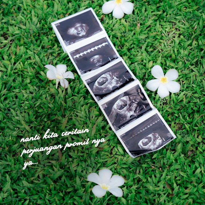 <p>Irish Bella juga mengunggah foto hasil USG kehamilannya ini ke publik. Meski sudah mengumumkan kehamilannya, Irish dan suami masih menyembunyikan usia kehamilannya ini, Bunda. (Foto: Instagram @_irishbella_)</p>