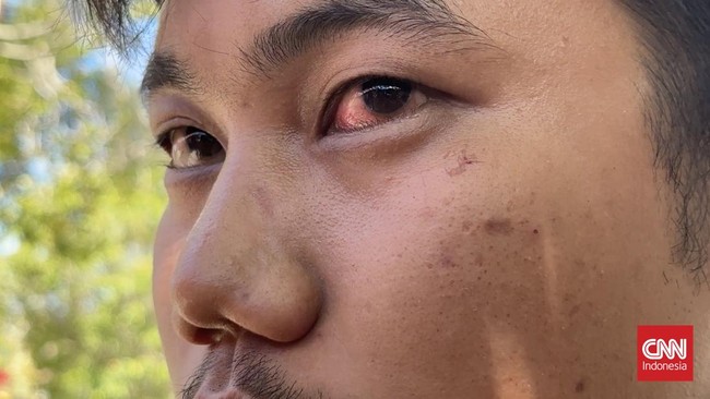 Seorang pria diduga Kombes Teddy Fanani, Direskrimum Polda Sumbar, memukuli pengendara di jalan menuju bandara. Kasus ini sedang diselidiki Polda Sumbar.