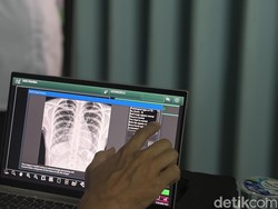 Ratusan Santri di Jakut Jalani Skrining TB Lewat CKG, Ada Temuan Kasus Positif