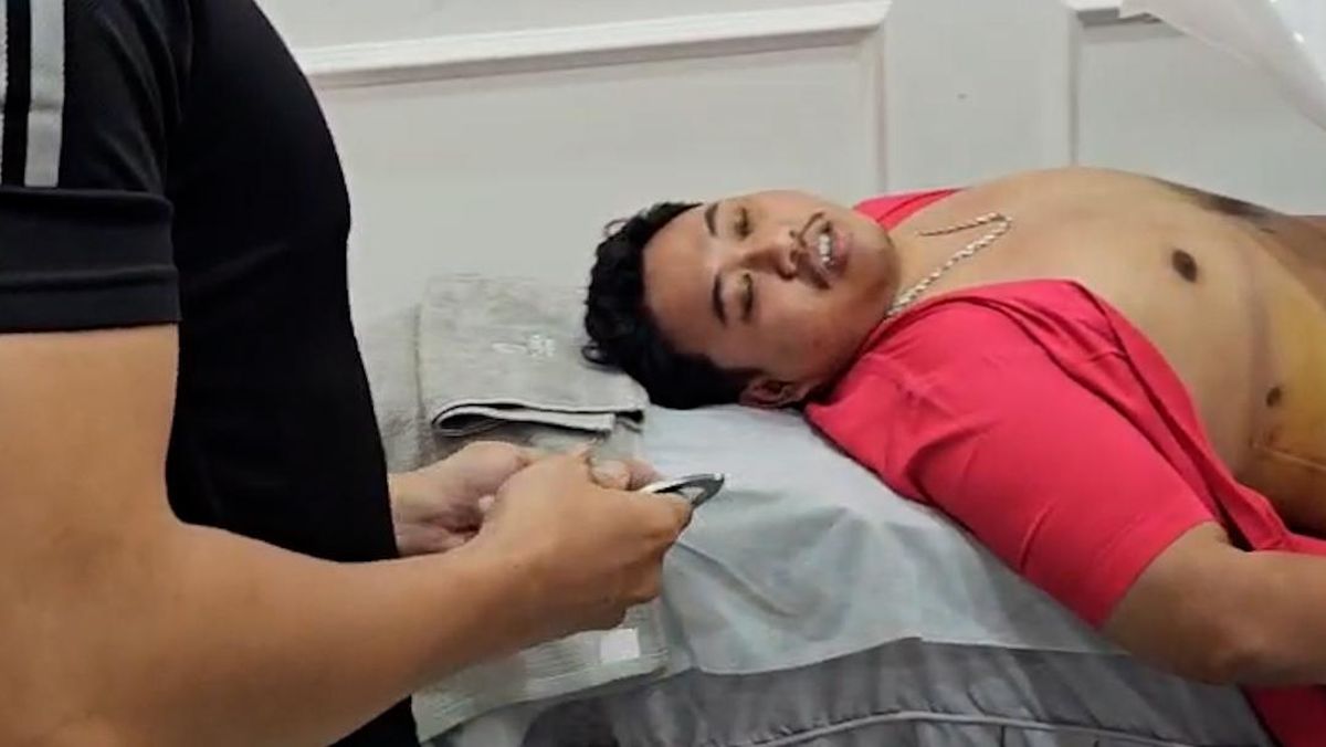 Momen Bos Gendut Gembong Narkoba Ditangkap Saat Jalani Sedot Lemak