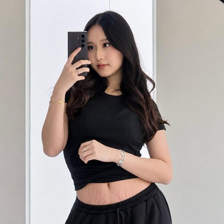 <p>Selain membagikan momen pumping dan stok ASIP, perjalanan Nita Vior sebagai ibu juga tidak lepas dari perubahan pada tubuhnya. Stretch mark menjadi salah satu perubahan pada tubuhnya yang muncul setelah kehamilan dan persalinan. (Foto: IInstagra@nitavior)</p>