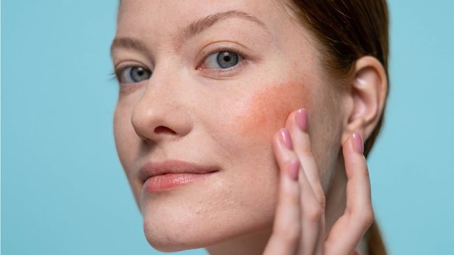 4 Cara Menentukan Jenis Kulit dengan Mudah