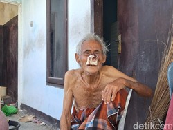 Bantu Amaq Kinah Penjual Kerupuk, Puluhan Tahun Bertahan dengan Tumor Hidung