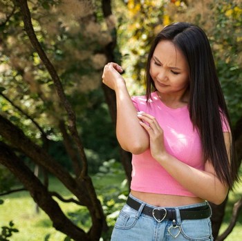 3 Tips yang Perlu Diperhatikan Bagi Pemilik Kulit Sensitif di Cuaca Makin Terik dan Berdebu
