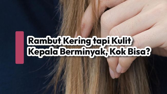 Rambut Kering tapi Kulit Kepala Berminyak, Kok Bisa?