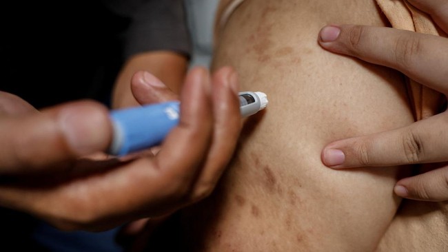 ATTENTION EDITORS, THIS PICTURE CAN ONLY BE USE IN RELATION TO HEALTH-OBESITY/INDONESIA Intan Permatasari, 14, receives an Ozempic injection at her home in Bogor, West Java province, Indonesia, August 21, 2025. By the time she was 4, Intan weighed 35