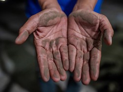 Paparan Debu Vulkanik Bisa Bikin Kulit Iritasi, Begini Cara Penanganannya