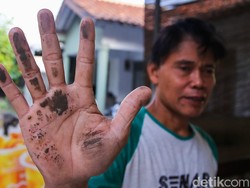 Abu Vulkanik Masuk Mata? Jangan Dikucek, Ini Anjuran Dokter