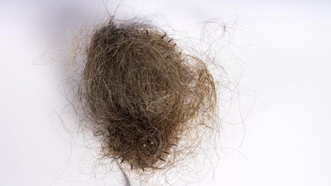 Fallen hair tangled in a white brush, isolated against a plain white background. A strong visual representation of hair loss and scalp issues. Perfect for illustrating hair care problems, or hygiene.