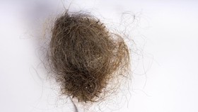 Fallen hair tangled in a white brush, isolated against a plain white background. A strong visual representation of hair loss and scalp issues. Perfect for illustrating hair care problems, or hygiene.