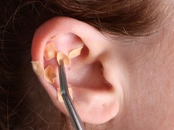 Viral Tren Atasi Stres dengan Ear Seeds, Banyak Digemari Idol K-Pop