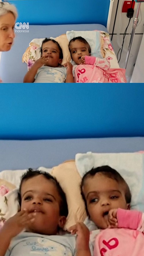 thumbnail video bayi kembar dipisahin