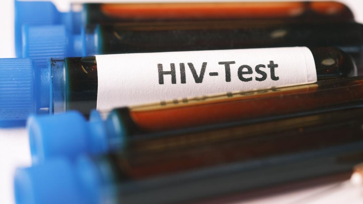 Kasus HIV Melonjak, Negara Ini Tetapkan Status Krisis Nasional