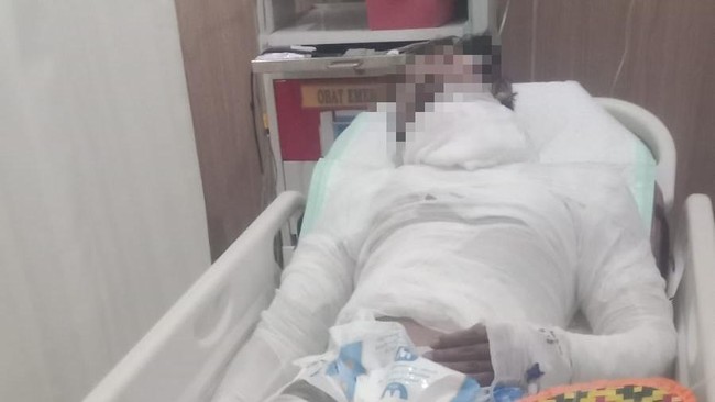 GS, sopir truk yang dibakar bos gara-gara persoalan uang setoran di Karangasem, Bali, Jumat (18/9/2026).