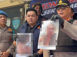 Polisi Ungkap Motif Pria di Jambi Siram Air Keras ke Istri Sirinya hingga Tewas