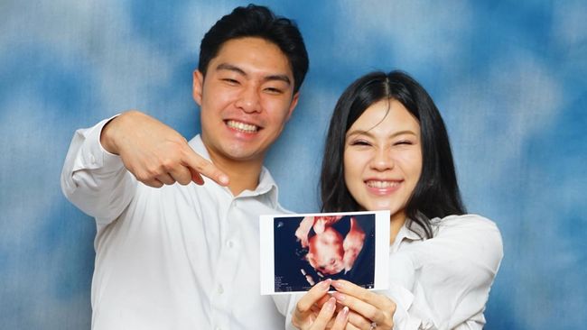 Jessica Jane dan Erwin Phang Umumkan Kehamilan Anak Pertama, Pamer Hasil USG