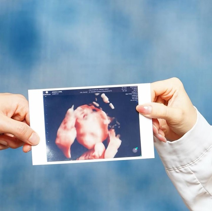 <p>Pemilik nama lengkap Gracia Jessica Jane juga memperlihatkan foto-foto USG calon anak pertamanya itu. Ia dan suami terlihat begitu bahagia dan antusias saat menunjukkan foto-foto USG calon anak pertamanya tersebut.(Foto: @jessicajane99).</p>